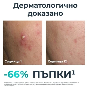 Eucerin DermoPure  Серум с тройно действие за склонна към акне и с петна от акне , 40ml